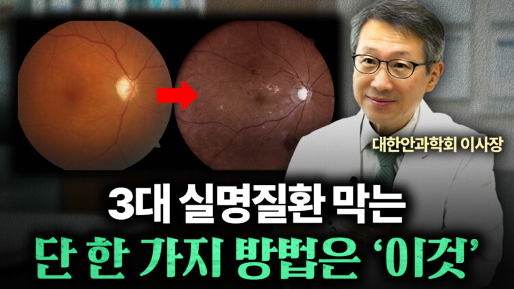 단 1분 검사로 실명 위험 예방?! 안저검사의 모든 것