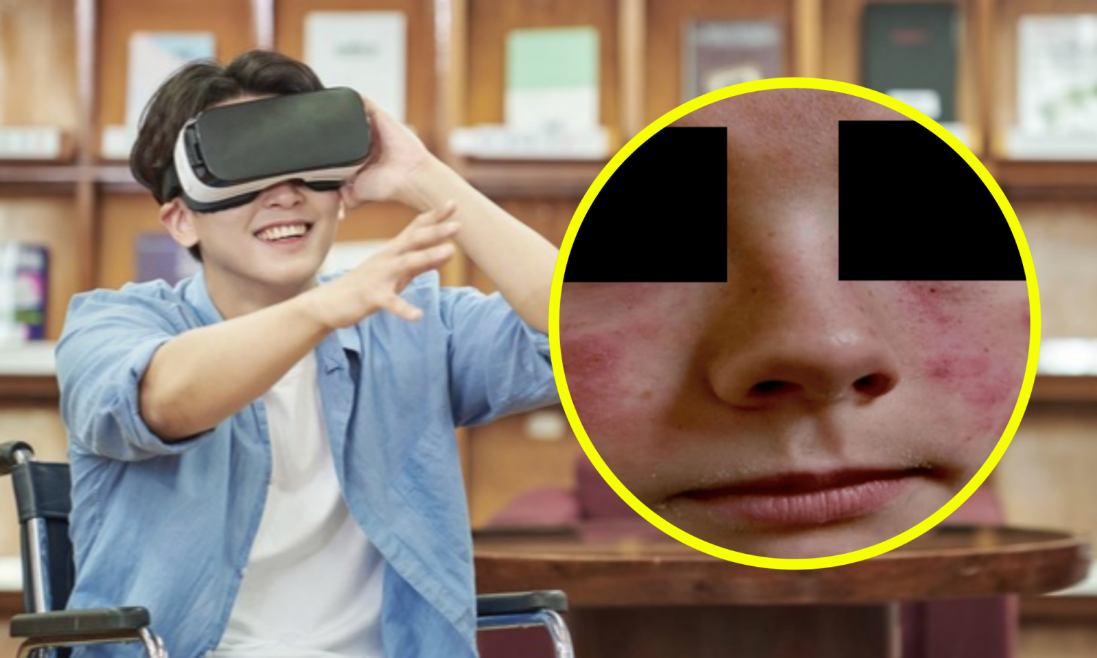 VR 헤드셋을 착용한 13살 소년이 얼굴 발진으로 병원을 찾았다. 검진 결과, 기기 폼 재질이 알레르기성 접촉 피부염의 원인으로 밝혀졌다. 사진=게티이미지뱅크, 큐어어스