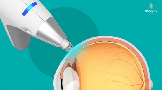 안구마취 의료기기 '오큐쿨', 국내 첫 美 FDA 드 노보 승인